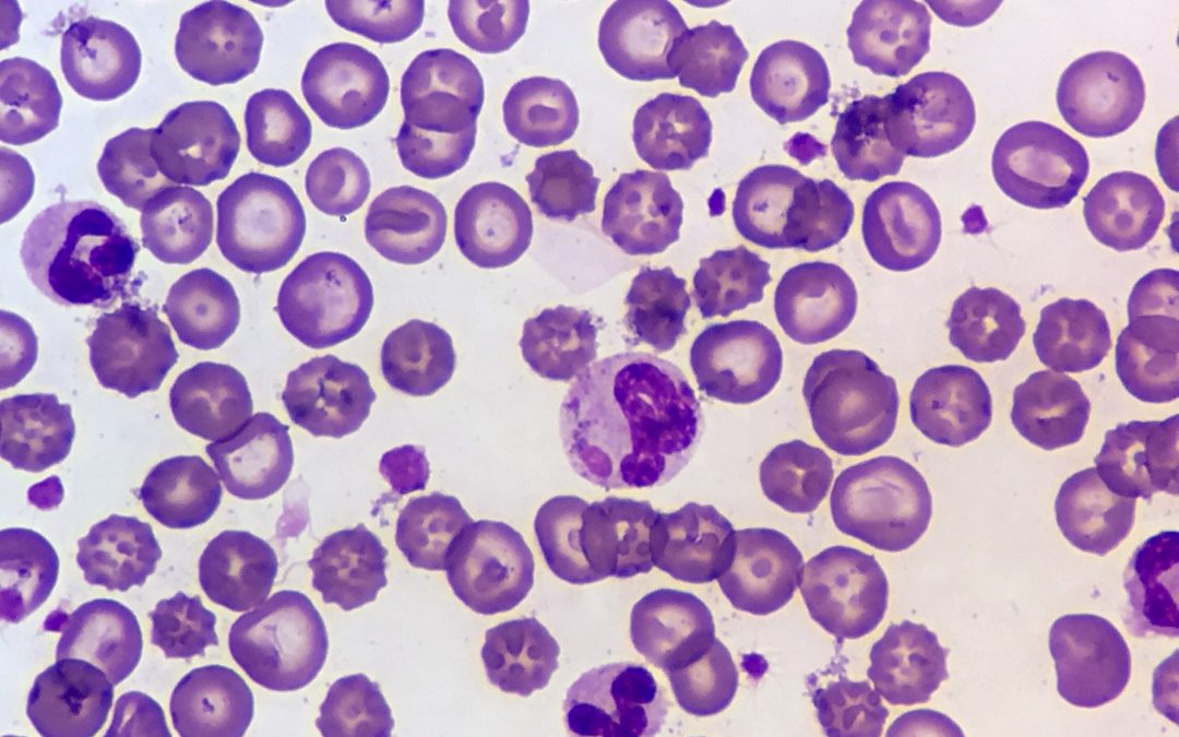 “Do-it-yourself” Smallpox study renews debate on ethical concerns in scientific research